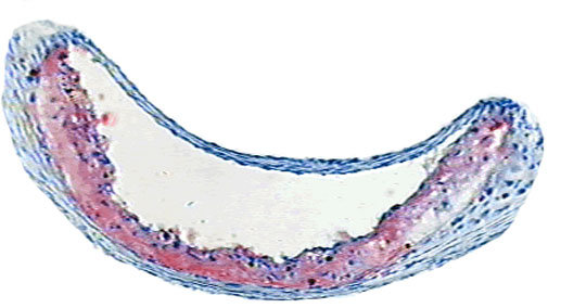 aorta de rat&oacute;n knock-out de apo-E 